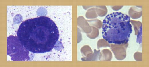 Photomicrograph of a human bone marrow mast cell (left) and a peripheral-blood basophil (right) stained with Wright-Giemsa. Images were acquired using an Olympus BX41 microscope equipped with a Planar 100×/1.25 oil lens and an Olympus Q Color 3 camera (Olympus America, Melville, NY) and were processed with Q Capture Pro version 5.1.1.14 software and Microsoft PowerPoint 2002 (Microsoft, Redmond, WA).