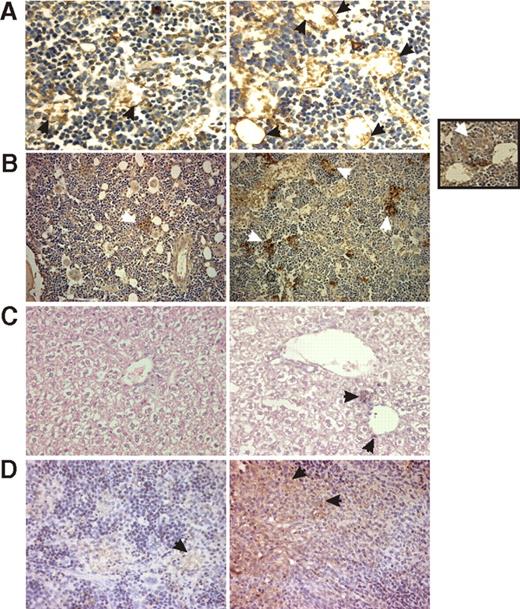 Figure 8. In vivo phenotypes of herg1-positive and herg1-negative leukemia blasts. Repopulation assay in NOD-SCID mice, inoculated with (1) herg1-negative (herg1−) and herg1-positive (herg1+) leukemia blasts from primary AML; two herg1− cases (cases A10 and A13 in Table 1) and two herg1+ cases (cases A34 and A42 in Table 1) were injected; (2) HL60 and of HL60 cells transfected with herg1a cDNA (hERG1-HL60). In these cells, herg1a mRNA expression was checked by RQ-PCR (Table 3). Data are representative of at least 3 mice per group. (A) Immunohistochemistry (IHC) with anti-mCD34 antibody on BM of mice inoculated with herg− (left) and herg+ (right) leukemia blasts from primary AML (magnification 250×). The arrows indicate CD34-positive vessels. (B) IHC with anti-hMHCI antibody on BM of mice inoculated with HL60 (left) and hERG1-HL60 (right) (magnification 200×). The arrows indicate niches of leukemia blasts. Inset, IHC with anti-hERG1 antibody on BM of mice injected with hERG1-HL60 (magnification 400×). The arrow indicates hERG1-positive leukemia cells. (C) IHC with anti-hMHCI on the liver of mice inoculated with herg− (left) and herg+ (right) leukemia blasts (magnification 400×). The arrow indicates niches of leukemia blasts. (D) IHC with anti-hMHCI on spleen of mice inoculated with HL60 (left) and hERG1-HL60 (right) (magnification 200×). The arrow indicates niches of leukemia blasts. Images were acquired on a Leica DM 4000B microscope with a Leica DFC 320 photocamera (Leica Microsystems) (PL Fluotar 40×/0.70, PL Fluotar 100×/1030 OIL objective). To determine BM angiogenesis, BM sections were stained with anti-CD34 antibodies. Vascular morphometric parameters were quantified following the procedure used by Korkolopoulou et al,30 with Leica DC Viewer software.