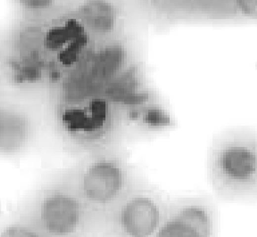 †. Characteristics of NOD-SCID mice inoculated with herg1− and herg1+ leukemia blasts, and with HL60 and hERG1-HL60 cells.