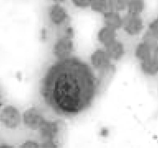 †. Characteristics of NOD-SCID mice inoculated with herg1− and herg1+ leukemia blasts, and with HL60 and hERG1-HL60 cells.