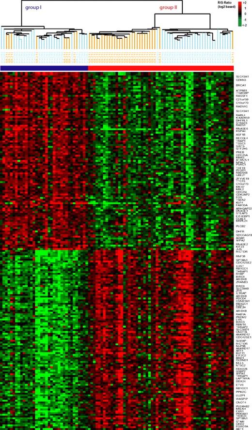 Figure 3. Hierarchical cluster-defined CBF subgroups. Subset of the top SAM genes (rows; ordered by SAM score) characterizing the hierarchical cluster-defined CBF subgroups. Mean-centered imputed gene-expression ratios are depicted by a log2 pseudocolor scale (indicated). The 93 CBF AML cases (columns) have been ordered according to the dendrogram of the unsupervised 2-way hierarchical cluster analysis (Figure 1). Owing to space limitations, only selected genes are indicated.