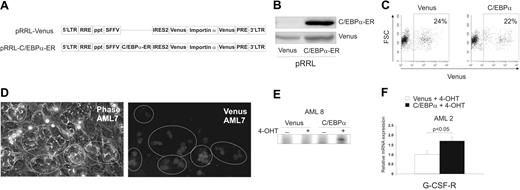 Figure 2. Reintroduction of C/EBPα in AML CD34+ cells. (A) Schematic overview of the lentiviral overexpression vectors used in these studies. (B) Western blot analysis of C/EBPα-ER in CD34+ CB stem/progenitor cells. (C) Transduction efficiency of CD34+ AML cells. (D) Phase-contrast and Venus fluorescence (GFP channel) pictures indicating the presence of Venus+ CAs (circled) in week 2 leukemic MS5 cocultures. See “Materials and methods; Microscopy and cytospins.” (E) DNA-binding experiment to C/EBPα-specific probe with nuclear extracts of 50 000 CD34+ AML cells from MS5 cocultures treated for 1 week with or without 500 nM 4-OHT. (F) Q-PCR for the C/EBPα target gene G-CSF-R after 1 week of coculture on MS5 in the presence of 500 nM 4-OHT. mRNA levels were normalized against GAPDH mRNA levels and C/EBPα-transduced values are shown relative to control Venus-transduced values. An average of 2 samples is shown with SEM.