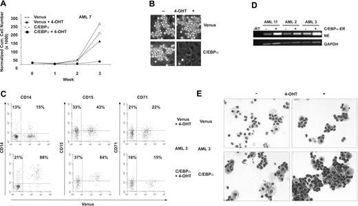 Figure 3. C/EBPα-ER impairs growth and expansion and induces differentiation of leukemic cells. (A) Cumulative growth cultures of AML cells (n = 7) on MS5 cells in the presence or absence of 500 nM 4-OHT. Half of the cultures were harvested weekly, and fresh medium was added to the culture. A representative example (AML no. 7) is shown, and all expansion data are summarized in Table 2. (B) Representative phase-contrast microscopy images of AML (no. 11) cocultures in the presence or absence of 500 nM 4-OHT on MS5 cells at week 3. Note the absence of phase bright suspension cells from C/EBPα-ER–transduced culture after treatment with 500 nM 4-OHT. One representative example is shown. (n = 7). (C) Flow cytometric analysis of suspension cells from week-1 leukemic MS5 cocultures in the presence of 500 nM 4-OHT. One representative example is shown. Also refer to Table 2. Indicated are the percentages of CD14+, CD15+, or CD71+ cells within the Venus− or Venus+ fractions. (n = 7). (D) RT-PCR analysis of neutrophil elastase (NE) expression in 3 AML samples after treatment with 500 nM 4-OHT in Venus-transduced cells (−) or in C/EBPα-ER–transduced cells (+). GAPDH expression is shown as loading control. −RT-PCRs were performed as negative control. (E) Morphologic analysis of suspension cells at week 1 of AML no. 3 was performed by MGG staining of cytospins. See “Materials and methods; Microscopy and cytospins.”