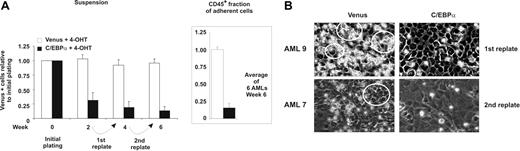 Figure 4. C/EBPα-ER impairs self-renewal of leukemic cells. (A) Transduced AML cells were subjected to serial replating experiments in the presence of 500 nM 4-OHT (n = 6) with cells from the adherent fraction. Every 2 weeks suspension cells were removed and analyzed by flow cytometry for Venus expression. The relative number of Venus+ cells in suspension cultures at initial plating (week 0) are set to 1, and subsequent weeks are shown relative to initial plating. The relative number of Venus+ cells within the adherent human CD45+ fraction was analyzed as well, where the number of Venus control adherent cells was set to 1 (box on the right). A total of 10% of the adherent fraction was replated onto fresh MS5 cultures, which were maintained for another 2 weeks, followed by a second replate. The average with SEM from 6 individual AML samples is shown. Venus percentages in suspension cultures at initial plating (week 0) are set to 1, and subsequent weeks are shown relative to initial plating. (B) Representative phase-contrast microscopy images of AML cocultures in the presence of 500 nM 4-OHT on MS5 cells after the first replate at week 4 (top row; AML no. 9), or after the second replate at week 6 (bottom row; AML no. 7). CAs are circled. See “Materials and methods; Microscopy and cytospins.”