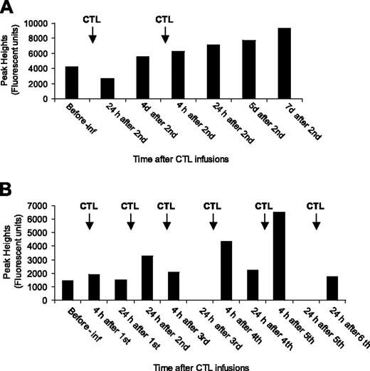 Figure 5. Monitoring of infused CTLs. PBMCs from patients' peripheral blood were analyzed by TCR spectratyping method to detect infused CTLs. (A) Trace analysis of BV subfamily 3 (204 base pair peak) in patient 17's PBMCs before and after infusion. (B) Trace analysis of BV subfamily 4 (341 base pair peak) in patient 22's PBMCs before and after infusion. Pre-inf indicates before CTL infusion; h, hours; and d, days.