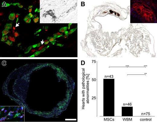 Figure 4. Bone formation origins from the MSC fraction of BM. (A) Cytosolic and extracellular (some marked by arrows) osteocalcin staining (Cy3, red) proved bone formation in a cryoinfarcted heart 13 days after injecting 5 × 106 EGFP+ whole BM-derived cells (green). The osteocalcin accumulation in the injected (EGFP+) cells revealed that these produce the bone tissue. Von Kossa staining in the same also heart showed calcifications (panel A inset). (B) Distinct calcifications (von Kossa staining) inside the lesioned, thinned-out ventricular wall of a cryoinfarcted heart harvested 369 days after injection of 1 × 106 EGFP+ whole BM cells. Osteocalcin staining (Cy3, red) of a subsequent section of the same heart revealed distinct bone formation without enclosed cells (panel B inset). Nuclei were stained with Hoechst dye (blue). (C) Prominent engraftment of EGFP+ cells (green) into the lesioned area 28 days after LCA and consecutive cytokine-induced mobilization of BM cells. Nuclei were stained with Hoechst dye (blue). CD45 staining (magenta) proved the hematopoietic origin of the engrafted cells (panel C inset). (D) Statistics of hearts with pathological abnormalities after infarction and injection of enriched MSCs (4 LCAs), whole BM cells (WBM, 2 LCAs), and controls (injection of vehicle, fibroblasts, hematopoietic progenitor cells, and mobilization of BM cells in reconstituted mice, 32 LCAs). P < .001 for MSCs vs WBM; P < .001 for MSCs vs control; and P = .002 for WBM vs control (2-sided Fisher exact test). Bar represents 24 μm (panel A), 50 μm (panel A inset), 750 μm (panel B), 380 μm (panel B inset), 940 μm (panel C), 40 μm (panel C inset). See “Materials and Methods; Image acquisition and preparation” for microscopy details.