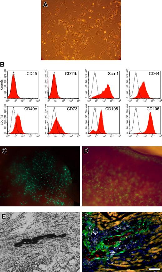 Figure 5. MSCs from peripheral blood; cell administration and tissue injury govern the fate of MSCs. (A) Adherent cell culture established from the peripheral blood of mobilized mice (passage 2); the cells displayed a fibroblast-like morphology as BM-derived MSCs. (B) Peripheral blood–derived MSCs (passage 6) expressed typical MSC markers as shown by flow cytometry analysis. (C) EGFP+ cells (green) were found in the lung directly after systemic injection of 1 × 106 MSCs (passage 8) into the femoralis vein; the mouse died immediately, likely because of acute right heart failure due to obstruction of lung capillaries by MSCs. (D) EGFP+ cells (green) were found in the spleen 5 days after slow injection of 1.5 × 106 MSCs (passage 8) into the tail vein. (E) Transplantation of 1.2 × 105 enriched MSCs (passage 6, 21 days) into the intact, uninfarcted heart resulted in calcifications (black, von Kossa staining) that were clearly restricted to the injection channel. (F) Tissue damage due to the injection needle was accompanied by inflammation documented by strong invasion of hematopoietic cells (CD45 staining, white). Engraftment of MSCs (green) was limited to the lesion (injection channel); osteocalcin staining (red) proved ossification. Autofluorescence of intact cardiomyocytes appeared yellowish. Bar represents180 μm (panel A), 700 μm (panel C), 350 μm (panel D), 100 μm (panel E), 60 μm (panel F). See “Materials and Methods; Image acquisition and preparation” for microscopy details.