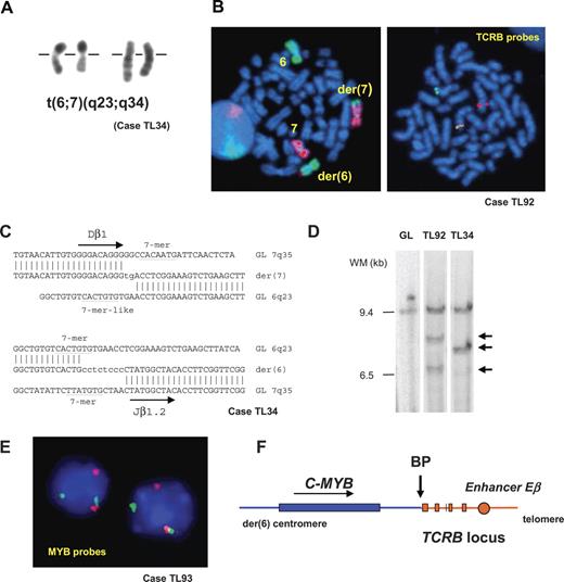 Figure 1. A recurrent translocation t(6;7)(q23;q34) in T-ALL involves the TCRB and C-MYB loci. (A) Partial R-banded karyotype with translocation t(6;7)(q23;q34). (B, left panel) FISH whole chromosome painting of chromosomes 6 (green) and 7 (red) on metaphases from leukemic cells confirmed the reciprocal translocation t(6;7). (B, right panel) Dual-color FISH analysis of the TCRB locus using TCRB-flanking probes (centromeric, CTD-3092H9 labeled in red; telomeric, RP11–168I15, labeled in green). Dissociation of the probes in leukemic cells with t(6;7) demonstrated the involvement of the TCRB locus as partner of the translocation. (C) Derivative sequences of t(6;7)(q23;q34) breakpoints in case TL34 and corresponding germ-line sequences. Recognition sequence signal (RSS) heptamer and putative heptamer-like sequence are indicated according to consensus53; untemplated nucleotides (N-diversity) are typed in lowercase. GL indicates germ line; der, derivative chromosomes. Breakpoint sequences for cases T142 and UPN5846 are shown in Figure S1. (D) Southern blot mapping of the translocation breakpoint in case TL92 using a 6q23.3 probe derived from BAC RP11–388E23. Germ-line (GL) and TL34 (TCRB-MYB) DNAs are shown as negative and positive controls, respectively. EcoRI rearranged bands are shown by arrows. (E) Interphasic FISH screening of T-ALL using flanking C-MYB locus probes RP11–845K5 (green) and RP11–184J4 (red) identified additional MYB-translocated cases TL33 and TL93, further shown to juxtapose the TCRB and C-MYB loci using combinations of FISH probes. (F) Schematic representation of the der(6) genomic region of t(6;7), according to data from the IMGT database and the UCSC Genome Bioinformatics site, and to the DNA derivative sequence of the breakpoint region in case T142. An arrow indicates the breakpoint (BP). See “Patients, materials, and methods; Cytogenetic and molecular analyses” for details about FISH image acquisition and manipulation.