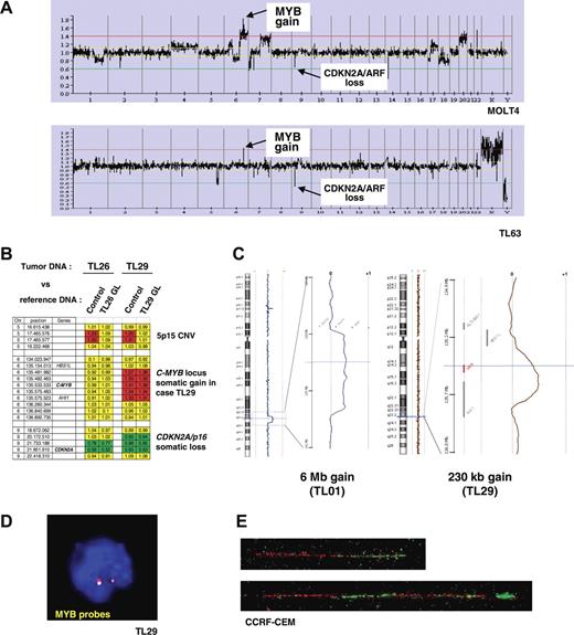 Figure 2. Identification of recurrent somatic genomic duplications at the C-MYB locus in T-ALL. (A) Global representation of large-scale analysis of genomic copy number using a 4K array-CGH in MOLT4 cell line (upper panel) and TL63 primary T-ALL case (lower panel). DNA copy gain at the C-MYB locus at 6q23 is indicated, as well as the DNA copy loss at the CDKN2A/p16/ARF locus at 9p21 as an example. (B) Compared analysis of array hybridization using as normal DNA either a healthy subject DNA (control) or germ-line DNA (GL) of the same patient as DNA reference. This analysis allowed us to distinguish copy-number variations (CNVs) and somatic genomic imbalances. As an example, a CNV at 5p15 was resolved in the TL26 and TL29 cases (a gain was observed when the leukemic DNA was cohybridized with an unrelated control DNA, but it disappeared using paired leukemic and GL controls). A somatic loss of CDKN2A/p16/ARF was evidenced in both the TL26 and TL29 cases, because the imbalance persisted after cohybridization with paired control; similarly the somatic gain at the 6q23/C-MYB locus was confirmed in case TL29. For each BAC/PAC of the array, gains were represented in red; losses, in green; and balanced signals, in yellow. (C) Copy-number analysis using a very high-density oligonucleotide array (Agilent), focused on the C-MYB region, enabled the minimal region of genomic gain to be mapped to approximately 230 kb. (C, right panel) A 6-Mb–sized copy gain region was found in case TL01; (left panel) a short minimal genomic gain including the C-MYB gene was evidenced in case TL29 (array-CGH performed with paired leukemic and GL DNAs). The genomic region of gain of chromosome 6 is magnified, with the horizontal cursor (blue) pointing out the C-MYB gene (shown in red in the right panel). The so-called “moving average” ratio between leukemic and GL DNA appears as a blue line in case TL01, and a brown line in case TL29. Two copies (alleles) of the locus appear as a moving average close to 0, whereas a DNA copy gain of an allele shifts the line close to ratio + 0.5 along the corresponding genomic region. (D) Interphasic C-MYB FISH using the RP1–32B1 (green) and RP3–388E23 (red) probes in the MYBdup cases showed no extra signal (except in the complex MOLT4 pseudotetraploid cell line, not shown), which suggests local duplication. (E) Molecular combing analysis using C-MYB locus probes RP11–55H4 (red) and RP11–166A21 (green) demonstrated a local duplication (bottom); the normal allele is shown on the top. See “Patients, materials, and methods; Cytogenetic and molecular analyses” for details about FISH image acquisition and manipulation.