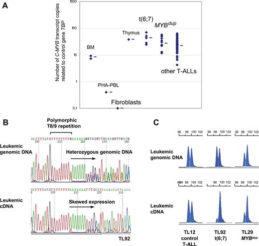 Figure 4. Expression analysis of the C-MYB gene in T-ALL. (A) C-MYB transcript levels were quantified by RQ-PCR in a series of samples: normal bone marrow (BM, n = 2), PHA-stimulated PBL (PHA-PBL, n = 1), growing fibroblasts (n = 1), thymus (n = 1), t(6;7) TCRB-MYB cases (n = 5, one case not available), MYBdup (n = 13), other T-ALL (n = 54) as indicated. Median value is indicated by a horizontal bar for each group. (B) Sequencing of C-MYB in TL92 tumor genomic DNA showed heterozygosity for a polymorphic T8/9 repetition in the 3′UTR region; sequencing of the TL92 leukemic cDNA in this TCRB-MYB case demonstrated a skewed allelic expression. (C) Analysis of the T8/9 polymorphic microsatellite using fragment size analysis. Heterozygous cases without C-MYB rearrangement (n = 27) showed balanced expression; heterozygous cases with t(6;7) translocation (n = 3; TL33, TL34, and TL92) showed a skewed expression of one C-MYB allele; and heterozygous cases with MYBdup (n = 7) showed an imbalanced profile of both leukemic genomic DNA and leukemic cDNA.