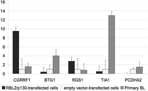 Figure 6. Quantitative RT-PCR of BL cell lines, either transfected with the empty vector or RBL2/p130, versus BL primary tumors to validate microarray analysis upon RBL2/p130 reintroduction. Error bars represent standard deviation.