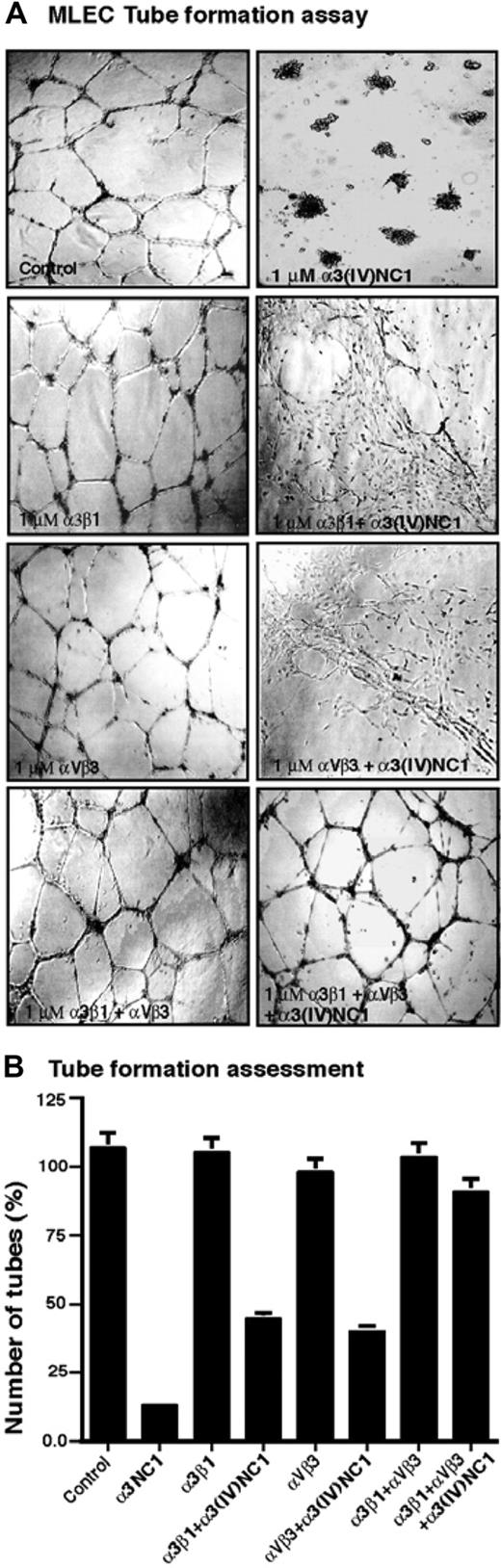 Figure 2. Tube formation assays. (A) Tube formation assay on matrigel was studied with or without α3(IV)NC1 and with different integrins (α3β1, αVβ3, or α3β1+αVβ3), with and without α3(IV)NC1 protein. Tube formation was evaluated after 48 hours using a Leitz Fluovert microscope (100×/1.25 NA), and representative fields were shown. Images were captured using a Flex Digital IEEE-1394 camera (Sheerin Scientific) and processed using SPOT advanced imaging software version 3.1.0 (Diagnostic Instruments, Sterling Heights, MI) and Adobe Photoshop 7.0 (Adobe, Redmond, WA). (B) Tube assay graphical representation. Average number of tubes formed (% values, with error bars indicating SEM) in 3 independent experiments is shown in the graph.