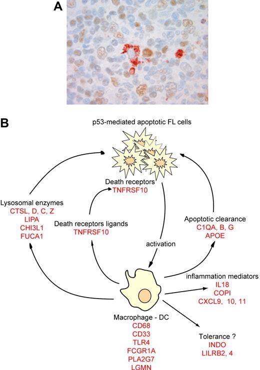 Figure 4. Immune response after low-dose radiotherapy in FL. (A) Postradiotherapy biopsies were stained with an anti-p53 antibody, revealed by a brown color, and a macrophage-specific CD68 antibody, revealed by a red color. Image was acquired with a ColorView (Mitsubishi, Tokyo, Japan) SIS CCD camera (400×, PlanApo, 40×/0.95) and DP Soft (Muenster, Germany) CVI 3.2 software. Results are representative of all macrophages found in the 5 patients tested. (B) Based on several genes overexpressed after radiation (in red), we propose a model for the molecular immune-reaction that follows low-dose radiotherapy.
