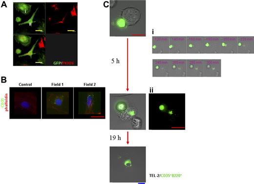 Figure 3. CD35+B220+ cells interact with and confer CD35+ characteristic to stromal cells. (A) PKH26-labeled CD35+B220+ cells were cocultured with CD45−CD35− splenic stromal cells from GFP-Tg mice for 24 hours, and the colocalization of PKH26 signals was observed and photographed with a Leica confocal microscope. Objective magnification, 63×/1.4 NA. 3-dimensional stacked images of cells with typical morphology, either round (i) or fibroblastic (ii), are shown. Cocultured cells in separate and merged color images for each staining are shown (top right, PKH26; top left, GFP; bottom left, merged image) with scale bar. (B) CD45−CD35− splenic stromal cells cocultured with CD35+B220+ cells for 5 days were stained with anti-CD35 mAb followed by Alexa-Fluor-488-conjugated anti-mouse IgG, as described under “Materials and methods.” F-actin was visualized with Cy3-phalloidin, and cell nuclei were stained with 4,6-diamidino-2-phenylindole (DAPI). Immunofluorescence images were obtained with a DeltaVision RT system. Objective magnification, 60×/oil 1.4 NA. Representatives of 3 independent experiments are shown. (C) TEL-2 stromal cells were cocultured with CD35+B220+ cells from GFP-Tg mice for 24 hours within the live cell imaging module. Immunofluorescence images merged or not merged with (panel Cii) DIG images were obtained with a DeltaVision RT system. DIC-fluorescence time-lapse images from 2 to 5 hours of 24-hour incubation period (15-second gap) are shown (panel Ci, corresponding time after incubation is indicated). Objective magnification, 60×/oil 1.4 NA. Representatives of 3 independent experiments are shown. Blue bar corresponds to 30 μm, yellow bar corresponds to 20 μm, and red bar corresponds to 15 μm.