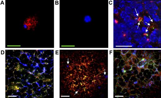 Figure 7. Immunohistochemical labeling of CD35+B220+ cells with ICs. (A-C) CD35+B220+ cells retain ICs on their surface. CD35+B220+ cells (A) or CD4+ T cells (B) were labeled with ICs and the retained ICs (red) on cell surface were visualized with HRP-conjugated anti-rabbit IgG followed by GenPoint (Dako Japan) signal enhancement system and streptavidin-conjugated Qdot605. (C) Retention of ICs (green) on the surface of PKH26-labeled CD35+B220+ cells (red) in vivo was assessed by injecting IC-pulsed, PKH-26-labeled CD35+B220+ cells into naive C57BL/6J-Jcl mice. On day 8, the splenic sections were prepared and ICs (green) were stained with HRP-conjugated antirabbit IgG followed by GenPoint signal enhancement system and SA-488. ICs on the surface of CD35+B220+ cells are indicated by arrows. (D-F) CD35+B220+-cell–derived reticular cells retain ICs. CD35+B220+ cells isolated from GFP-Tg mice were injected intravenously into naive C57BL/6J-Jcl mice, and frozen sections of spleen were prepared 15 days later. Splenic sections were then incubated with ICs and freshly prepared mouse serum, and ICs (panels D and E, red) were visualized with goat anti-HRP Ab followed by Cy3-conjugated anti-goat IgG. CD35 (panel D, blue) or CD68 (panel E, blue) was visualized with biotin-conjugated anti-CD35 mAb or biotin-conjugated anti-CD68 mAb, respectively, followed by streptavidin-conjugated Cy5, and the GFP signal was enhanced with Alexa-488-conjugated anti-GFP antibody. CD68+ cells are indicated by arrows (panel E). In panel F, lymphoid-follicle–like structures were formed by intradermally injecting FDC-M1−CD35+B220+ cells from GFP-Tg mice together with TEL-2 stromal cells. A frozen section of lymphoid-follicle–like structure was labeled with ICs (red) and anti-CD35 mAb (blue), as described. All immunofluorescence images were obtained using a DeltaVision RT system. Red bars, 200 μm; white bars, 20 μm; green bars, 5 μm. Objective magnification, 20×/0.75 NA or 60×/oil 1.4 NA. A representative of 3 independent experiments is shown.