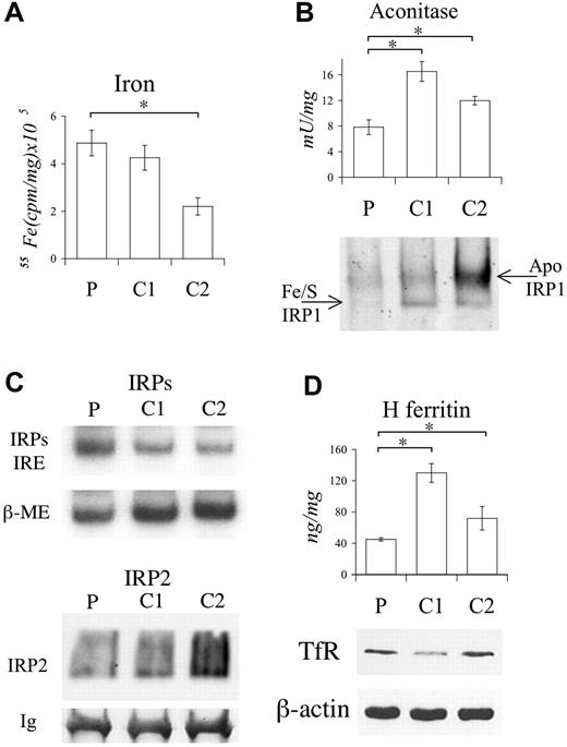 Figure 2. Functional studies on LCLs. (A) Cytosolic 55Fe incorporation in proband (P) and 2 controls (C1 and C2). Cells were incubated with 2 μM 55FeAC and after 18 hours cpm determined in postmitochondrial fractions (PMFs). (B; top) Cytosolic aconitase activity in P and controls. (Bottom) Determination of IRP1 conformation by immunoblotting of native PAGE. Separated Fe/S- and apo-IRP1 proteins are indicated by arrows. β-actin (shown in panel D) was used to confirm equal protein content. (C; top) IRE-IRPs electro mobility shift assay (EMSA). β-ME (beta-mercaptoethanol) was used to evaluate the total binding activity. (Bottom) Western blotting after immunoprecipitation of LCL extracts using anti-IRP2. Equal immunoprecipitation was verified by revealing immunoglobulins (Ig's). (D; top) H ferritin determined by specific ELISA. (Bottom) Western blotting of TfR. Equal loading was verified by β-actin. The experiments were repeated 3 times. Representative pictures are shown. Error bars represent standard deviations. *P < .01.