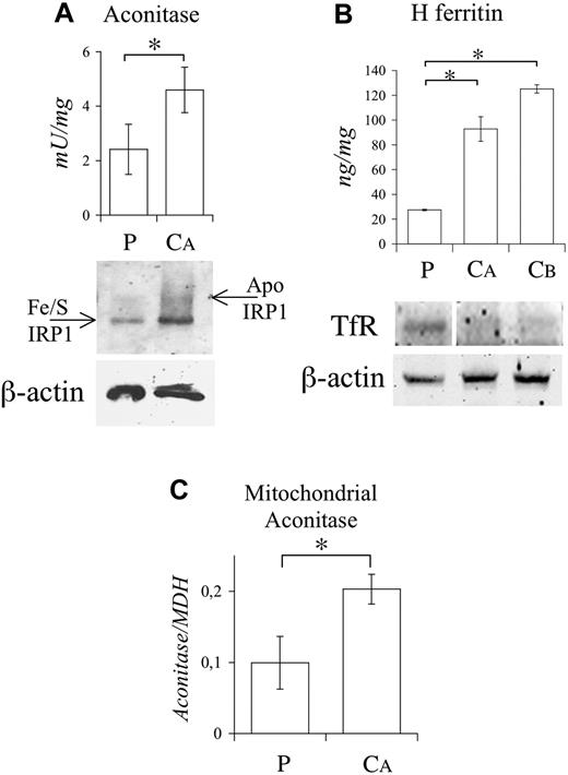 Figure 3. Functional studies on PBMCs. (A; top) Cytosolic aconitase activity in P and control. (Bottom) IRP1 conformation studies performed as described in Figure 2B. (B; top) H ferritin levels by ELISA. (Bottom) Western blotting of TfR. The vertical white line indicates a deleted lane in the same blot. Equal loading was verified by β-actin. (C) Mitochondrial aconitase activity as measured spectrophotometrically and normalized on mitochondrial malate dehydrogenase (MDH) activity. The experiments were repeated twice. Representative pictures are shown. Error bars represent standard deviations. *P < .01.
