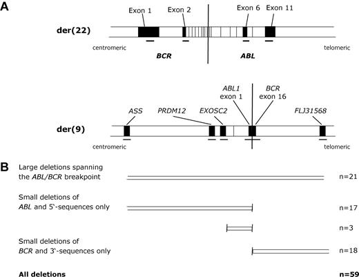 Figure 1. Summary of the multiplex ligation-dependent probe amplification assay to detect derivative chromosome 9 deletions. (A) Map showing positions of the der(9) and der(22) probes (not to scale). Probes on the der(9) were designed to detect deletions, whereas der(22) probes acted as controls. (B) Summary of patient results.