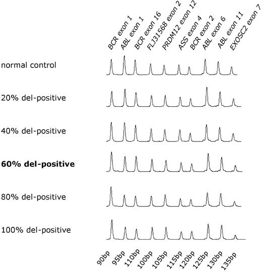 Figure 2. Sensitivity of multiplex ligation-dependent probe amplification assay. MLPA traces of chronic myelogenous leukemia DNA known to harbor a large der(9) deletion diluted in nondeleted DNA. The relative ratios of der(9) to control der(22) probes reduces as the proportion of patient DNA increases.