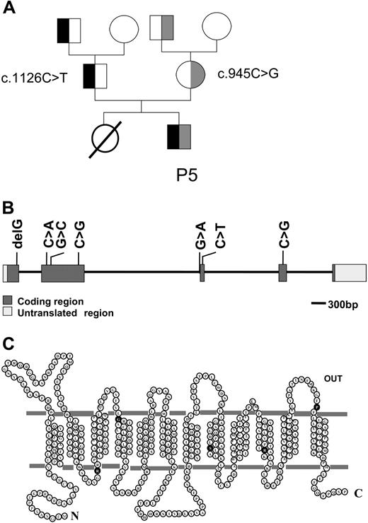 Figure 2. Pedigree of a family with HFM; localization of PCFT mutations. (A) Pedigree of the family of patient P5. The black color indicates the c.1126C > T mutation, and the gray color indicates the c.954C > G mutation. (B) The genomic organization of the PCFT gene and the location of mutations detected in patients with HFM. (C) The location of amino acid substitutions (●) associated with mutations in PCFT gene in a topological structure predicted by online databases (ExPASy Proteomics Tools10 and Transport Classification Database11).