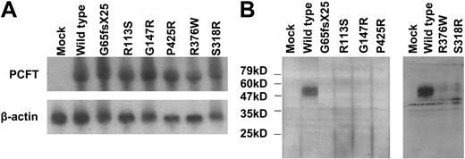 Figure 4. Northern and Western blot analyses of PCFT mutants. (A) Northern blot analysis. Total RNA (20 μg) was fractionated on a formaldehyde-agarose gel, and the blot was successively probed with a PCFT fragment and β-actin. The images represent 1 of 2 independent experiments. (B) Western blot analysis. An equal amount of lysate (20 μg) was loaded on SDS gels, and the blots were probed with a peptide antibody directed to the C-terminus of PCFT. The numbers on the left indicate the molecular sizes of the protein ladder. The left and right panels represent 2 different analyzes each with mock and wild-type PCFT as controls. Each blot is representative of 3 separate experiments.