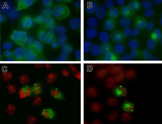 Figure 5. Immunofluorescence staining of PCFT. HeLa cells were transiently transfected with cDNA of wild-type and PCFT mutants and labeled with a rabbit antibody targeted to human PCFT. (A) Wild-type PCFT. (B) P425R. (C) R376W. (D) S318R. Green fluorescence indicates localization of PCFT, while the blue fluorescence (panels A-B) or red fluorescence (panels C,D) shows nucleus counterstained by DAPI or PI, respectively. The image is a representative view from at least 3 experiments. The same antibody was used for immunohistochemical and Western blot (Figure 4B) analyses. The image was obtained on Olympus 1X70 inverted Epifluorescence Microscope (Olympus) with a 60×/1.40 oil objective, recorded on a Sensicam QE cooled CCD Camera (Applied Scientific Instrumentation), acquired with software IP Lab 4.0 (BD Biosciences) and further processed with Photoshop CS (Adobe Systems).