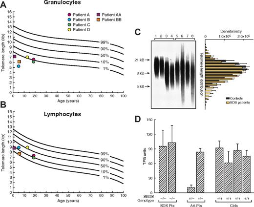 Figure 2. Telomere length in peripheral blood leukocytes. (A,B) Telomere length in peripheral blood granulocytes and lymphocytes from patients with acquired aplastic anemia (AA) carrying 258 + 2 T>C SBDS gene mutation (●) and patients with Shwachman-Diamond syndrome (SDS; ■). Telomere lengths were measured by flow fluorescence in situ hybridization analysis. Lines represent the 1st, 10th, 50th, 90th, and 99th percentiles of telomere length in age-matched healthy controls' granulocytes and lymphocytes, based on a reference group of 400 persons. (C) Telomere length of leukocytes also was measured by Southern blot allowing quantification of length heterogeneity by calculating the coefficient of variation (CV). Length heterogeneity was significantly increased in SDS patients compared with healthy controls. Lanes 1 and 2, umbilical cord blood of healthy subjects; lanes 3 and 4, age-matched healthy subjects; lanes 5 to 8, patients with SDS. Bar graphic on the right represents the analysis of variation of optical density (mean ± SEM) in telomere length for controls (1-4) and SDS patients (5-8), indicating the higher variability in telomere length in SDS patients. (D) Cultured lymphocytes from patients with SDS (−/−), with acquired AA heterozygous for SBDS gene 258 + 2 T>C mutation (+/−), and healthy controls (+/+) were assayed for telomerase activity using the fluorescent telomeric repeat-amplification protocol (TRAP). Telomerase activity was measured in quadruplicate and indicated in total product generated (TPG) units. Error bars represent standard deviation.