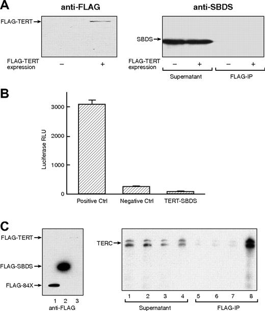 Figure 3. Lack of physical interaction between SBDS and telomerase complex components. (A) FLAG-tagged TERT construct was transfected into HeLa and HEK 293T cells. Left panel illustrates HeLa cell lysates transfected (+) or not transfected (−) with FLAG-TERT probed for FLAG-TERT with an anti-FLAG monoclonal antibody, indicating effective TERT expression. Immunoprecipitation with anti-FLAG antibody was performed and precipitates probed for SBDS (right panel). (B) TERT-SBDS interaction was further explored using the 2 hybrid system. Luciferase activity indicates close proximity of NF-κB and yeast GAL4. (C) Association between SBDS and TERC RNA. TERC RNA was synthesized in vitro and incubated with rabbit reticulocyte lysate (RRL) expressing FLAG-TERT, FLAG-SBDS, FLAG-SBDS-84X, or empty vector (left panel; lane 1, RRL expressing FLAG-SBDS-84X; lane 2, RRL expressing FLAG-SBDS; and lane 3, RRL expressing FLAG-TERT). Following FLAG immunoprecipitation, RNA was extracted from the precipitates and examined for TERC. Right panel illustrates Northern blot for TERC: lane 1, non-transfected RRL supernatant; lane 2, FLAG-SBDS-84X-transfected RRL supernatant; lane 3, FLAG-SBDS-transfected RRL supernatant; lane 4, FLAG-TERT-transfected RRL supernatant; lane 5, non-transfected RRL precipitate; lane 6, FLAG-SBDS-84X-transfected RRL precipitate; lane 7, FLAG-SBDS-transfected RRL precipitate; lane 8, FLAG-TERT-transfected RRL precipitate. Despite the low expression FLAG-TERT by the RRL, it efficiently precipitated TERC. In contrast, large amounts of FLAG-SBDS and FLAG-SBDS-84X failed to precipitate TERC to any appreciable degree.