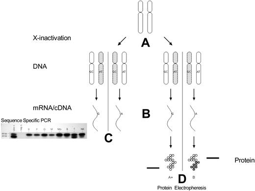 Figure 2. Clonality detection by mRNA (exonic polymorphisms) and protein polymorphisms. (A) X-chromosome inactivation occurs early in embryonic development. (B) mRNA transcription occurs only from the active X chromosome (with some exceptions). (C) Analysis of peripheral blood mRNA of a female with polycythemia vera. The amplified products can be differentiated by sequence-specific polymerase chain reaction of cDNA followed by ligase reaction detection. bp indicates base pair standards; pos c., positive control; neg c., negative control (no mRNA added to reaction mixture); R, reticulocytes; P, platelets; M, monocytes; Mo, cultured macrophages; B, B lymphocytes; T, T lymphocytes; NK, natural killer cells. (D) G6PD A and B isoforms can be differentiated by electrophoretic mobility.