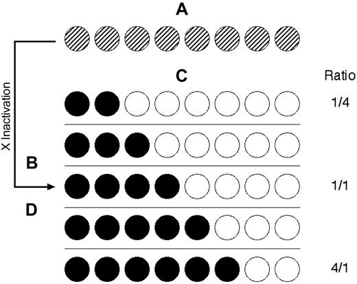 Figure 4. Stochastic/genetic skewing of X chromosome inactivation. (A) Both X chromosomes are active in early embryonic stem cells. Crosshatching represents the active X chromosomes of maternal (black) and paternal (white) origin. (B) X chromosome inactivation choice is stochastic resulting in (C) variance of the maternal/paternal inactivated X chromosome ratio from the theoretical 1:1. (D) Genetic factors can also affect the choice of X chromosome inactivated, resulting in skewed maternal/paternal inactivated X chromosome ratios. These skewed populations can result in a false determination of clonality.