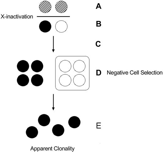 Figure 5. Somatic selection after X-chromosome inactivation. (A) Early embryonic cells express both X chromosomes and undergo X-chromosome inactivation. (B) After inactivation, embryonic cells express one or the other X chromosome. Thus, in a disease like Wiskott-Aldrich syndrome, a heterozygous female can express both the normal and mutant alleles, albeit in different cells. (C) The embryonic cells undergo proliferation. (D) Cellular selection against the cells bearing the active X chromosome with the mutant allele results in elimination of that population of cells, resulting in (E) an apparently clonal (“pseudoclonal”) population.