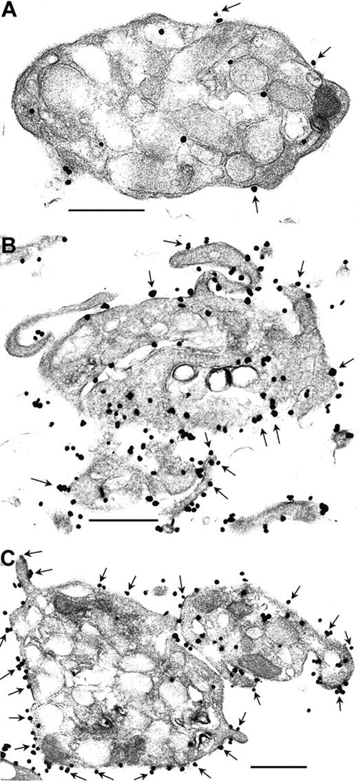 Figure 1. Ultrastructural immunonanogold localization of SNAP-23 in resting and activated human platelets. (A) Resting platelets demonstrate SNAP-23 staining on the plasma membrane, α-granule membranes, and on membranes of the OCS. SNAP-23 label is observed on the extracellular surface of the plasma membrane (arrows). (B) SFLLRN-stimulated and (C) PMA-stimulated platelets demonstrate more intense staining. In addition, there is abundant SNAP-23 staining on the extracellular surface of the plasma membrane (arrows). Bars, 0.5 μm. See “Materials and methods, Immunofluorescence microscopy” for image acquisition information.
