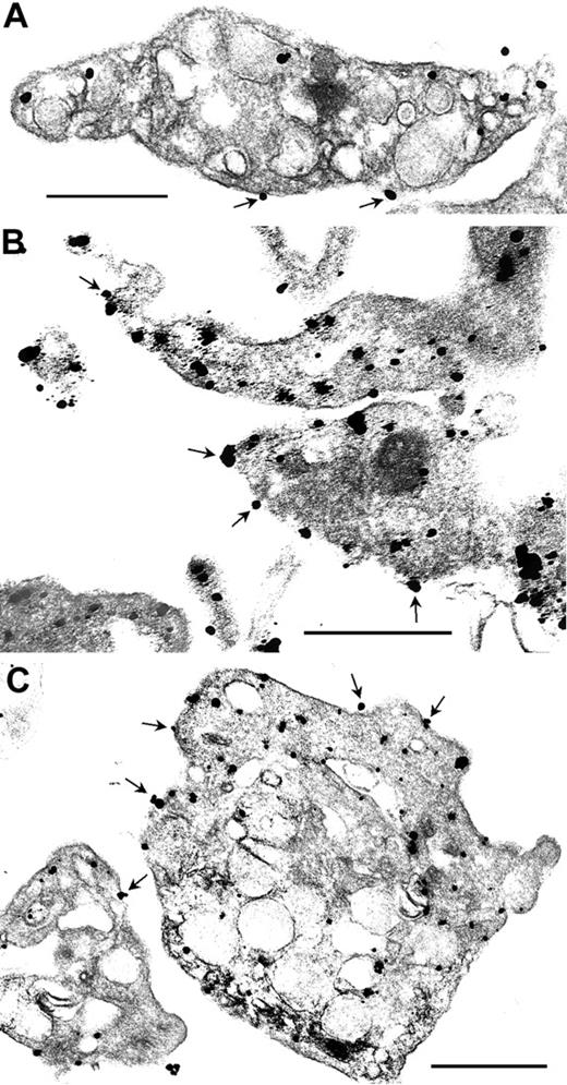Figure 2. Ultrastructural immunonanogold localization of syntaxin-2 in resting and activated human platelets. (A) Resting platelets demonstrate syntaxin-2 staining on the plasma membrane, α-granule membranes, and on membranes of the open canalicular system. Occasional staining is observed on the extracellular surface of the plasma membrane (arrows). (B) SFLLRN-stimulated and (C) PMA-stimulated platelets demonstrate more intense staining generally and increased staining of syntaxin-2 on the extracellular surface (arrows). Bars, 0.5 μm. See “Materials and methods, Immunofluorescence microscopy” for image acquisition information.