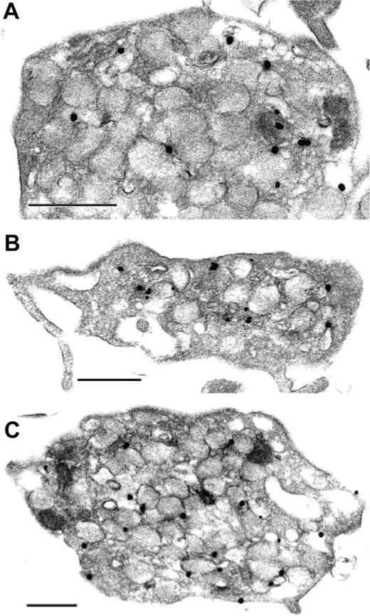 Figure 3. Ultrastructural immunonanogold localization of VAMP-3 in resting and activated human platelets. (A) Resting platelets demonstrate VAMP-3 staining primarily on platelet α-granules. Occasional staining is observed on membranes of the OCS. No staining of VAMP-3 on the extracellular surface is observed. (B) SFLLRN-stimulated and (C) PMA-stimulated platelets do not demonstrate VAMP-3 on their extracellular surface. Bars, 0.5 μm. See “Materials and methods, Immunofluorescence microscopy” for image acquisition information.