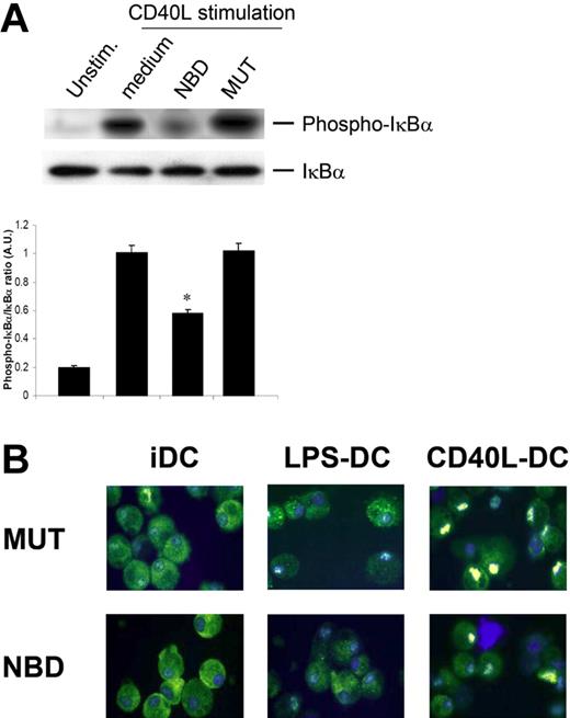 Figure 2. NBD peptide selectively blocks canonical NF-κB activation. (A) NBD peptide blocks CD40L-induced IκBα phosphorylation. Monocyte-derived DCs were preincubated with either NBD peptide or MUT peptide for 2 hours. Subsequently, cells were stimulated with CD40L for 30 minutes, extensively washed, and lysed in sample buffer. Cell lysates were analyzed by Western blotting and densitometry was performed. One representative experiment of 3 is shown; densitometry includes data from all experiments (*P < .05). (B) NBD peptide completely blocks nuclear translocation of RelB following LPS stimulation, whereas CD40L-induced RelB translocation is only marginally affected. Series of confocal images of monocyte-derived DCs stimulated for 4 hours with LPS or CD40L in the presence or absence of NBD/MUT peptides or controls. Cells were centrifuged onto glass slides, fixed in cold acetone, and stained for RelB expression. Nuclei were stained with Hoechst, and cells were analyzed by scanning the entire cell using a confocal laser microscope. In the displayed overlay pictures, RelB nuclear translocation can be evaluated. Representative pictures from one experiment are shown. Results are representative of 3 independent experiments. See “Materials and methods, Immunofluorescence staining” for image acquisition information.
