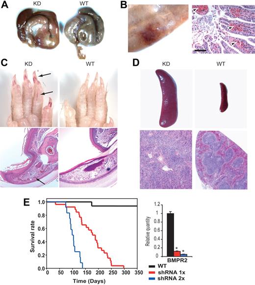 Figure 2. Gross phenotype of Bmpr2-deficient mice. (A) Massive bleeding in the cecum. Tissues from a WT littermate are shown in comparison. (B) H&E-stained sections (right) of a segment of ileum (left) from a Bmpr2 KD mouse. Arrowheads indicate extravasated erythrocytes in the lamina propria. (C) Vascular lesions in the cutaneous extremities. The lesions appeared as redness under the nail bed and dilated capillaries in the histology sections (arrows). Wild-type tissue is shown in comparison. (D) Enlarged spleen as a result of regenerative response to anemia in Bmpr2 KD mice. The follicles were disorganized, and there were clear signs of extramedullary hematopoiesis. See “Materials and methods, Histopathology, immunohistochemistry, and immunoblotting” for detailed image acquisition information. (E) Survival curves of mice hemizygous (shRNA 1×) or homozygous for the shRNA transgene (shRNA 2×). The bar graph represents the relative Bmpr2 mRNA expression in the lung of mice with either one of 2 copies of the shRNA transgene, as determined by RT-PCR. Values are means plus or minus SD. *P < .01.