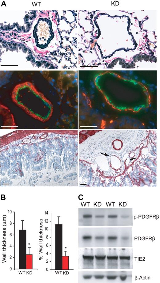 Figure 4. Defective mural cell coverage of blood vessels from Bmpr2 KD mice. (A) (Top) Elastin-Van Gieson staining of pulmonary arteries from wild-type or Bmpr2 KD mice. Note the rarified appearance of the tunica media. (Middle) Immunoflurescence staining of pulmonary arteries using anti-VWF, labeling endothelial cells, and anti-α-actin, labeling smooth muscle cells. (Bottom) Antismooth muscle α-actin immunohistochemistry of the large intestine. Arrows indicate areas missing SMCs. Bars = 50 μm. (B) Quantification of average wall thickness and wall thickness relative to external diameter of muscular, preacinar pulmonary arteries. Values are means plus or minus SD. *P < .01. (C) Immunoblots of lung extracts from 2 wild-type and 2 KD mice with the indicated antibodies.
