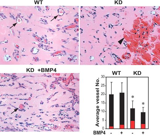 Figure 6. Abnormal angiogenesis in Bmpr2 KD mice. Representative H&E-stained sections of Matrigel loaded with 200 ng/mL bFGF 7 days after implantation into the WT or Bmpr2 KD mice are shown. Gel implants in WT mice mount robust neoangiogenesis and form well-defined, cell-lined vessels (arrows), whereas specimens from Bmpr2 KD mice show increased hemorrhage and congestion (arrowhead), which were partially alleviated by the presence of exogenously supplied BMP4. Bar graph at lower right shows average number of RBC-containing vessels and tubular structures (black bar) or large blood pools (red bar) counted per × 400 microscopic field. Values are means plus or minus SD. *P < .05.