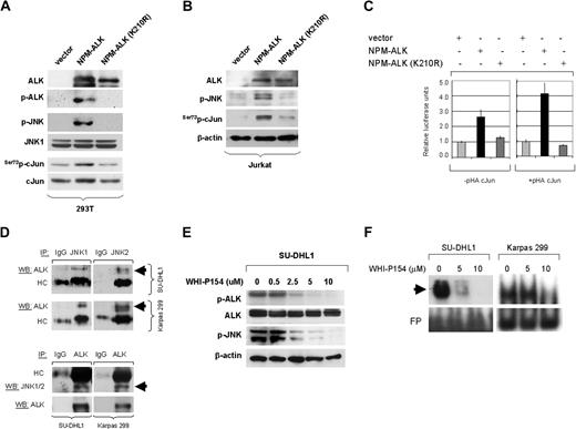 Figure 3. NPM-ALK activates JNK and cJun and Induces AP-1 transcriptional activity. (A) HEK 293T cells were stably transfected with expression plasmids including empty vector (pDest40), active NPM-ALK, or mutant NPM-ALK (K210R) with a kinase-dead domain. Expression of NPM-ALK, in cells transfected with functional or kinase-dead mutant NPM-ALK, was confirmed by Western blot analysis using the ALK1 antibody. ALK activity in cells transfected with the functional NPM-ALK construct was confirmed using an antibody specific for phosphorylated ALK. Stable expression of functional NPM-ALK in HEK 293T cells resulted in JNK phosphorylation/activation, which was associated with phosphorylation of cJun at serine 73 and an increase in total c-Jun levels that is attributable to positive autoregulation of cJun transcription. Total JNK1 expression served as a protein loading control in this experiment. (B) Jurkat cells were transiently transfected with 50 μg of empty vector (pDest40), active NPM-ALK, or mutant, kinase-dead NPM-ALK (210K>R), and whole-cell lysates were prepared at 48 hours after transfection. Immunoblots showed that transient expression of the functional NPM-ALK in Jurkat cells resulted in a substantial increase of p-JNK, which was associated with increased phosphorylation of cJun. (C) To study the NPM-ALK–induced AP-1 transcriptional activity, Jurkat cells were transiently transfected with a luciferase reporter gene under the control of a promoter that contains 3 successive AP-1 specific binding sites (3×AP-Luc) together with an empty expression vector or expression plasmids encoding for the functional or kinase-dead mutant NPM-ALK. Two sets of experiments were performed with or without cotransfection of a full-length cJun expression plasmid (pHA-cJun). After 48 hours the cells were collected to determine luciferase activity. The results showed an increase in relative luciferase units in cells expressing the functional NPM-ALK, indicating an increase in AP-1 transcriptional activity. The transcriptional activity was enhanced in Jurkat cells by coexpression of full-length cJun (right panel). The fold activation compared with the basal activity of the AP-1 promoter sites in cells transfected with the empty vector, which was set to 1. All measurements were performed in triplicate; bars indicate standard error. (D) Coimmunoprecipitaion studies were performed in SU-DHL1 and Karpas 299 cells. Whole-cell lysates were first immunoprecipitated with JNK1, JNK2, or control IgG1 antibodies, and then immunoblotted using specific ALK antibody. Conversely, whole-cell lysates were also immunoprecipitated with ALK or control IgG1 antibodies and then immunoblotted using a JNK1/2 antibody that detects both JNK1 and JNK2. The same membrane was also probed with ALK antibody. The top 2 arrows show a specific band at 80 kDa (NPM-ALK), indicating that NPM-ALK physically interacts with JNK1 and JNK2 in ALK+ ALCL cells. The bottom arrow indicates detection of JNK1/2 by Western blot analysis after inverse coimmunoprecipitation that further confirmed the physical interaction between NPM-ALK and JNKs. Immunoglobulin heavy chain (HC) served as a loading control. (E) SU-DHL1 and Karpas 299 cells were treated with the inhibitor WHI-P154 at concentrations (0, 0.5, 2.5, 5, or 10 μM), previously shown to inhibit JAK3 and ALK enzymatic activity. Whole-cell lysates were prepared at 24 hours after treatment. Immunoblots demonstrate that ALK phosphorylation is decreased at a concentration of 2.5 μm, and correlates with decreased phosphorylation (activation) of JNK. (F) Inhibition of ALK enzymatic activity in NPM-ALK+ ALCL cells resulted in decreased AP-1 DNA binding activity in a concentration-dependent manner as shown by EMSA and autoradiography (black arrow). SU-DHL1 and Karpas 299 cells were treated with the inhibitor WHI-P154 at concentrations of 0, 5, or 10 μM. After incubation for 24 hours, nuclear extracts were prepared and assessed by EMSA using double-stranded consensus AP-1 oligonucleotide. Free DNA (free probe, FP) is shown in the bottom of the gel.