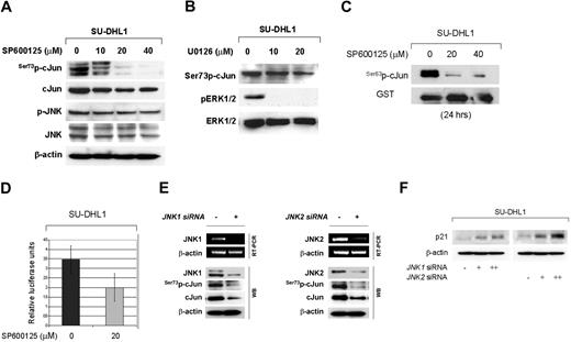 Figure 4. cJun phosphorylation is mediated by the JNK group of MAPKs in NPM-ALK+ ALCL cells. (A) SU-DHL1 cells were treated with the specific JNK inhibitor, SP600125, at concentrations of 0, 10, 20, or 40 μM. Whole-cell lysates were prepared at 48 hours and immunoblots showed that inhibition of JNK activity resulted in decreased Ser73p-cJun levels in a dose-dependent manner. This decrease was detectable at a concentration of 10 μM, but it was more prominent at a concentration of 20 μM. A decrease in cJun protein level was also observed because of an autoregulatory mechanism of cJun on its own transcription. (B) Treatment of SU-DHL1 cells with U0126, a specific inhibitor of the MEK1/2 group of MAPK kinase, was performed at concentrations of 0, 10, and 20 μM. After incubation for 48 hours, whole-cell lystates were prepared and immunoblots showed decreased ERK1/2 phosphorylation, indicating sufficient ERK inactivation. However, this did not result in decreased cJun phosphorylation. These results suggest that JNKs, but not ERK, mediate cJun activation in NPM-ALK+ ALCL. (C) JNK activity was assessed using an in vitro kinase assay using GST-cJun as a substrate. SU-DHL1 cells were treated with the specific JNK inhibitor, SP600125, at concentrations of 0, 20, and 40 μM. After 24 hours of incubation, cells were collected and whole-cell lysates were prepared and incubated with the GST-cJun substrate. Immunoblots showed that inhibition of JNK activity is associated with decreased cJun phosphorylation in vitro. (D) SU-DHL1 cells were transfected with AP-1-Luc reporter plasmid and, after incubation for 24 hours, were treated with the specific JNK inhibitor SP600125 at concentrations of 0 and 20 μM. After 24 hours the cells were collected to determine luciferase activity. The graph shows a substantial decrease in AP-1 promoter activity after JNK inhibition. Bars indicate standard error. (E) To further investigate the role of JNK1/2 isoforms in cJun activation, SUDHL1 cells were transiently transfected with 20 μg of siRNA selectively targeting JNK1 or JNK2 gene products, and endogenous JNK1/JNK2 expression levels were confirmed by RT-PCR, as well as by Western blot analysis. Cells were harvested at 48 hours after transfection and mRNA and whole lysates were prepared. RT-PCR and immunoblots confirmed JNK1 or JNK2 silencing. cJun phosphorylation was decreased after knocking down JNK1 or JNK2 in immunoblots. (F) SU-DHL1 cells were transiently transfected with 0, 10, and 20 μg of JNK1 or JNK2 or control siRNA, and whole cell lysates were prepared at 48 hours after transfection. Immunoblots demonstrate upregulation of p21 protein levels in a concentration-dependent manner.