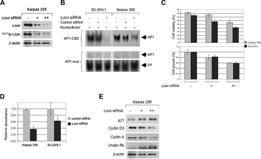 Figure 6. Inhibition of cJun expression reduces cell growth in NPM-ALK+ ALCL cells. (A) NPM-ALK+ ALCL cells were transiently transfected with 10 μg or 20 μg (SU-DHL1) and 20 μg or 40 μg (Karpas 299) cJun or control siRNA, and whole-cell lysates from both cell lines were prepared at 48 hours after transfection. Western blot analysis showed that endogenous cJun was almost completely silenced when 40μg siRNA was used. As expected, decreased levels of Ser73p-cJun were also observed. (B) Silencing of cJun gene expression in NPM-ALK+ ALCL cells resulted in decreased AP-1 DNA binding activity as shown by EMSA and autoradiography (first row, black arrow). SU-DHL1 and Karpas 299 cells were transiently transfected with 20μg c-Jun siRNA. After incubation for 48 hours, nuclear extracts were prepared and assessed by EMSA using double-stranded consensus AP-1 oligonucleotide. Mutant AP-1 oligonucleotide served as a negative control (second row). Free probe (FB, DNA oligonucletides) is shown in the bottom panel. (C) Selective silencing of cJun gene expression resulted in decreased cell viability (top panel) and a more prominent decrease in proliferation of viable cells (bottom panel) as assessed by trypan blue exclusion and MTS assays, respectively. The data presented are the mean (± SD) in triplicate measurements. (D) Reduced cell proliferation in NPM-ALK+ ALCL cells is attributable to cell-cycle arrest, because cJun silencing also resulted in decreased S-phase fraction evaluated by BrdU incorporation studies. Results have been normalized to those of control siRNA samples. (E) Western blot analysis after transient transfection of NPM-ALK+ ALCL cells with specific cJun siRNA showed upregulation of p21 and underphosphorylated Rb in a concentration-dependent fashion, as well as downregulation of cyclin A and cyclin D3.