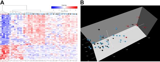 Figure 2. Cluster identification of patients for whom induction has failed in T-ALL. (A) Hierarchic clustering of samples (columns) and genes (rows) shows differential expression for patients in the IF (red triangle), RE (black square), and CCR (blue circle) cohorts. Red cells indicate high expression, and blue cells indicate low expression. (B) In 3-dimensional principal component analysis (PCA), 50 T-ALL samples were projected in the feature space based on differential expression for 116 probes. Each sphere represents a sample: red spheres denote IF patients, black spheres indicate RE postinduction remission, and blue spheres show patients who have remained in CCR for longer than 4 years. In panels A and B, the patients for whom induction failed clustered together, indicating a unique and shared genetic signature.