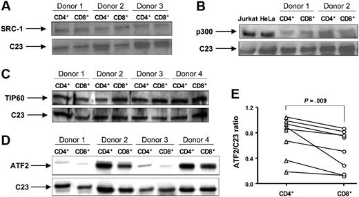Figure 5. The expression of HATs SRC-1, p300, TIP60, and ATF2 in normal CD4+ and CD8+ lymphocytes. Nuclear or whole-cell proteins were extracted from purified CD4+ and CD8+ T cells. The expression of (A) SRC-1, (B) p300, (C) TIP60, and (D) ATF2 was evaluated by Western blot. C23 was used as a loading control for nuclear proteins. Nuclear extracts from Jurkat T cells and HeLa cells were used as positive controls for the anti-p300 antibody. Vertical lines have been inserted to indicate where a gel lane was cut. These gels came from 2 different experiments. (E) The ratio of AFT2 to C23 was calculated as a ratio of density for AFT2 and C23 bands measured with National Institutes of Health (Bethesda, MD) Image 1.63 software.