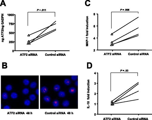 Figure 6. Inhibition of ATF2 gene expression using specific siRNA in human CD4+ decreases the transactivation activity of steroids. Introduction of ATF2 siRNA into CD4+ T cells resulted in specific inhibition of ATF2 expression as shown by (A) real-time PCR and (B) immunostaining (original magnification ×630; blue, DAPI, nuclear staining; red, cy3, ATF2; see “Materials and methods, GCRα nuclear translocation” for more detailed image acquisition information). The pictures are representatives of 4 independent experiments. Silencing of ATF2 resulted in a significant decrease of DEX-induced (C) MKP-1 and (D) IL-10 production by human CD4+ T cells (n = 4) compared with a nonspecific siRNA control group.