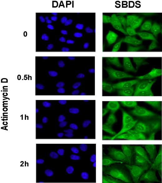 Figure 1. Nucleolar localization of SBDS is abrogated by actinomycin D treatment. HeLa cells were treated with 2 nM actinomycin D for the times indicated. Cells were fixed and stained for SBDS (green) and counterstained with DAPI (blue) to visualize nuclei (63× magnification). See “Patients, materials, and methods; Immunofluoresence” for image acquisition details.