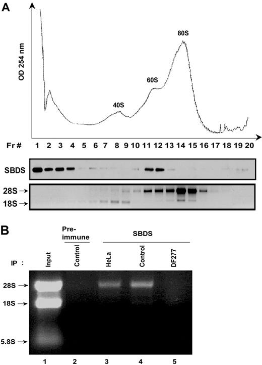 Figure 3. SBDS cosediments with the 60S ribosomal precursor subunit and associates with the 28S ribosomal RNA. (A) HeLa cell lysates were fractionated on a 10% to 30% sucrose gradient by ultracentrifugation. Absorbance at 254 nM across the gradient is shown (top panel). Proteins were precipitated from equal aliquots of each fraction and immunoblotted for SBDS (middle panel). RNA was extracted from equal volumes of each fraction and analyzed by agarose gel electrophoresis and ethidium bromide staining (bottom panel). Data shown are representative of results obtained from 3 independent experiments. (B) Endogenous SBDS was immunoprecipitated from nuclear extracts of HeLa cells, healthy control lymphoblasts (control), or DF277 lymphoblasts derived from an SDS patient. Preimmune serum was used as a negative control for the immunoprecipitation (lane 2). RNA was extracted from the immunoprecipitates and analyzed by agarose gel electrophoresis and ethidium bromide staining. Data shown are representative of results obtained from 3 independent experiments.