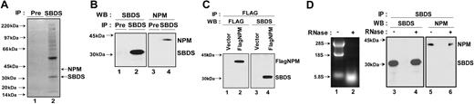 Figure 4. SBDS associates with nucleophosmin in an RNA-independent manner. (A) Endogenous SBDS was immunoprecipitated from HeLa nuclear extracts with an anti-SBDS antibody. The immunoprecipitated proteins were separated by sodium dodecyl sulfate–polyacrylamide gel electrophoresis on a 4% to 12% Bis-Tris gel followed by Coomassie blue staining. Preimmune serum (Pre) was used as a negative control for the immunoprecipitation (lane 1). Protein bands from the SBDS immunoprecipitate (lane 2) were excised and analyzed by tryptic digestion and matrix-assisted laser description/ionisation time of flight (MALDI-TOF) mass spectrometry. (B) HeLa cell lysates were incubated with either anti-SBDS antibody or preimmune serum (Pre). The immunoprecipitates were analyzed by Western blotting for SBDS (lanes 1 and 2) and NPM (lanes 3 and 4). (C) 293T cells were transfected with either FLAG-NPM (lanes 2 and 4) or empty pFLAG-CMV vector (lanes 1 and 3). Cell lysates were immunoprecipitated with an anti-FLAG antibody. The resulting precipitates were immunoblotted for FLAG (lanes 1 and 2) or SBDS (lanes 3 and 4). (D) HeLa cell lysates were incubated at 30°C for 20 minutes in the presence (lane 2) or absence (lane 1) of 4 μg RNase A. RNA was extracted and analyzed by agarose gel electrophoresis and ethidium bromide staining (left panel, lanes 1 and 2). SBDS was immunoprecipitated from the mock-treated and RNase-treated lysates. The resulting pellets were analyzed by immunoblotting (right panel) for SBDS (lanes 3 and 4) and NPM (lanes 5 and 6).