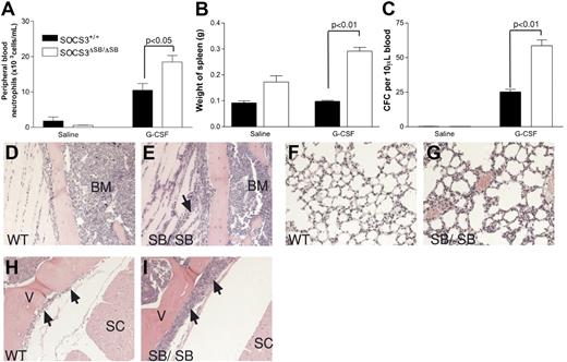 Figure 4. Increased progenitor cell mobilization in SOCS3ΔSB/ΔSB mice in response to G-CSF stimulation in vivo. SOCS3+/+ and SOCS3ΔSB/ΔSB mice (4 per group) were injected intraperitoneally twice daily with either 2.5 μg/kg G-CSF or endotoxin-free saline/BSA vehicle for 5 days. Mice were killed on day 6. Results are means (± SD). (A) Peripheral blood neutrophil count. (B) Spleen weight. (C) Peripheral blood colony-forming cells. Peripheral blood (10 μL for G-CSF–treated, 30 μL for vehicle-treated) from all mice was cultured in triplicate in the presence of SCF/IL-3 for 7 days, fixed and stained, and the number of colonies was counted at × 40 magnification. Histologic examination showed increased neutrophil infiltration into the following: (D,E) Parasternal muscles. The arrow indicates neutrophils between the muscle fibers. (E,F) Lung. Note the thickening of the alveolar walls, due to increased numbers of neutrophils, in SOCS3ΔSB/ΔSB mice. (H,I) Intrathecal space. A transverse section through the spinal column at the level of the thoracic vertebrae reveals increased numbers of intrathecal granulocytes in the SOCS3ΔSB/ΔSB mice. BM indicates bone marrow; V, vertebral column; and SC, spinal cord.