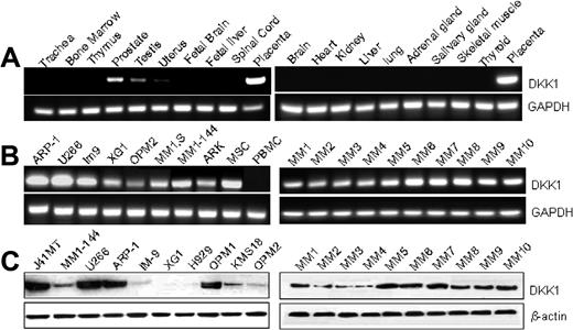 Figure 1. Expression of DKK1 gene and protein in normal tissues and myeloma cells. (A) RT-PCR showing DKK1 gene expression in placenta, prostate, uterus, and testis but not in other tissues. (B) RT-PCR showing DKK1 gene expression in all myeloma cell lines and primary tumor cells from 10 patients and in MSCs but not in PBMCs. (C) Western blots showing DKK1 protein expression in most myeloma cell lines and primary tumor cells from all 10 patients. Representative results of 4 independent experiments are shown.
