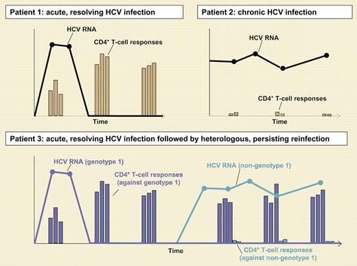 Typical CD4+ T-cell responses in 3 patients with different courses of HCV infection. Patient 1 clears the virus in the presence of sustained vigorous and multispecific CD4+ T-cell responses. In patient 2, who has chronic HCV infection, CD4+ T-cell responses are hardly detectable. Patient 3 goes through acute, resolving HCV genotype 1 infection, resulting in sustained vigorous and multispecific CD4+ T-cell responses. Later, patient 3 is reinfected with a heterologous, HCV non–genotype 1 infection. The vigorous and multispecific CD4+ T-cell responses detectable in the patient represent remainders from the previous genotype 1 infection and do not prevent persistence of the HCV non–genotype 1 infection.